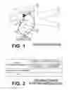 Fig. 02 - Analyzing ECG data in deciding on patient chest compression treatment