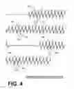 Fig. 04 - Analyzing ECG data in deciding on patient chest compression treatment