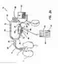 Fig. 03 - Bymixer apparatus and method for fast-response, adjustable measurement of mixed gas fractions in ventilation circuits