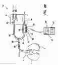 Fig. 04 - Bymixer apparatus and method for fast-response, adjustable measurement of mixed gas fractions in ventilation circuits