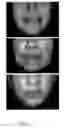Fig. 06 - METHODS FOR MEASURING CHANGE IN LIP SIZE AFTER AUGMENTATION