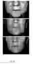 Fig. 07 - METHODS FOR MEASURING CHANGE IN LIP SIZE AFTER AUGMENTATION