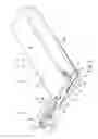 Fig. 02 - Device for treating hallux varus