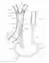 Fig. 01 - Method and apparatus for treating a carotid artery