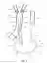 Fig. 02 - Method and apparatus for treating a carotid artery