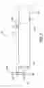 Fig. 06 - Method and apparatus for treating a carotid artery