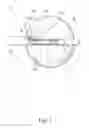 Fig. 02 - CARDIAC ABLATION SYSTEM WITH INFLATABLE MEMBER HAVING MULTIPLE INFLATION SETTINGS