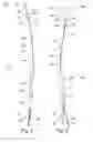 Fig. 03 - Handle for an ablation device