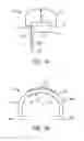 Fig. 02 - DEVICE FOR RESECTION OF TISSUE