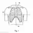Fig. 02 - STRUCTURED STERNAL INCISION