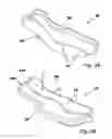 Fig. 04 - STRUCTURED STERNAL INCISION