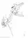 Fig. 04 - Reloadable Laparoscopic Fastener Deploying Device