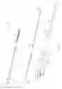 Fig. 02 - Apparatus, method and system for the deployment of surgical mesh