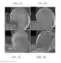 Fig. 02 - Materials and methods for nerve repair