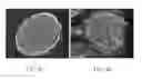 Fig. 07 - Materials and methods for nerve repair
