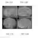Fig. 09 - Materials and methods for nerve repair