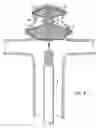 Fig. 06 - DEVICES AND METHODS FOR TREATING VASCULAR MALFORMATIONS