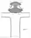 Fig. 07 - DEVICES AND METHODS FOR TREATING VASCULAR MALFORMATIONS