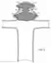 Fig. 08 - DEVICES AND METHODS FOR TREATING VASCULAR MALFORMATIONS