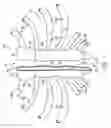 Fig. 02 - Methods for sternal closure