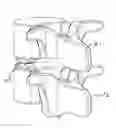 Fig. 01 - Devices and methods for inter-vertebral orthopedic device placement