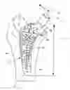 Fig. 01 - PROSTHETIC BODY FOR AN UPPER LEG PROSTHETIC