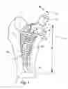 Fig. 02 - PROSTHETIC BODY FOR AN UPPER LEG PROSTHETIC
