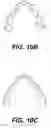Fig. 10 - Virtual orthodontic treatment