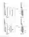 Fig. 06 - Magnetic clasp unit and suspender system