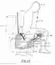 Fig. 16 - Anal-genital viewing device and method