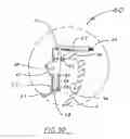 Fig. 19 - Anal-genital viewing device and method