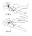 Fig. 28 - Tension locking tool