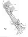 Fig. 05 - Electric toothbrush