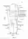 Fig. 06 - Orthotic devices and methods for manufacturing same