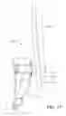 Fig. 12 - Assault rifle buttstock aiming and stabilization system