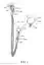 Fig. 02 - EARRING
