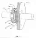 Fig. 08 - Balance test indexing tool for balance-testing a rotor