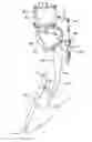 Fig. 01 - Accelerator pedal apparatus