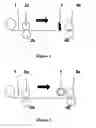 Fig. 02 - METHOD FOR SLITTING A METAL SHEET BEFORE FOLDING