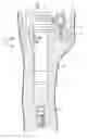 Fig. 01 - Plughole waterproofing device for engine