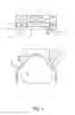 Fig. 03 - Method for the production of a piston for internal combustion engines and piston for an internal combustion engine