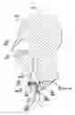 Fig. 02 - TRACHEOSTOMY TUBE HAVING A CUFFED INNER CANNULA