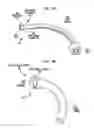 Fig. 09 - TRACHEOSTOMY TUBE HAVING A CUFFED INNER CANNULA