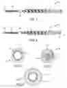 Fig. 02 - Method and apparatus for endometrial ablation in combination with intrafallopian contraceptive devices