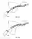 Fig. 06 - Method and apparatus for endometrial ablation in combination with intrafallopian contraceptive devices