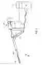 Fig. 07 - Method and apparatus for endometrial ablation in combination with intrafallopian contraceptive devices