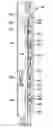 Fig. 01 - DOWNHOLE VALVE
