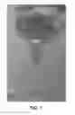 Fig. 02 - Lost circulation control fluids for naturally fractured carbonate formations
