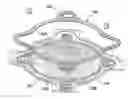 Fig. 01 - Electrolytic cell stack with proton exchange membrane interlock sealing gasket