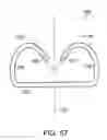 Fig. 49 - Surgical stapler having a closure mechanism